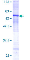 CTSL / Cathepsin L Protein - 12.5% SDS-PAGE of human CTSL stained with Coomassie Blue