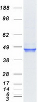 CTSL / Cathepsin L Protein - Purified recombinant protein CTSL was analyzed by SDS-PAGE gel and Coomassie Blue Staining