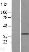 CTSO Protein - Western validation with an anti-DDK antibody * L: Control HEK293 lysate R: Over-expression lysate