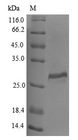 CTSO Protein - (Tris-Glycine gel) Discontinuous SDS-PAGE (reduced) with 5% enrichment gel and 15% separation gel.