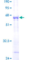 CTSO Protein - 12.5% SDS-PAGE of human CTSO stained with Coomassie Blue