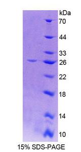 CTSO Protein - Recombinant Cathepsin O (CTSO) by SDS-PAGE
