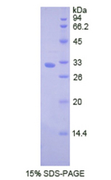CTSV / Cathepsin V Protein - Recombinant Cathepsin V By SDS-PAGE