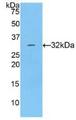 CTSV / Cathepsin V Protein - Active Cathepsin V (CTSV) by WB