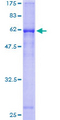 CTSW / Cathepsin W Protein - 12.5% SDS-PAGE of human CTSW stained with Coomassie Blue
