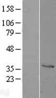 CTSZ / Cathepsin Z Protein - Western validation with an anti-DDK antibody * L: Control HEK293 lysate R: Over-expression lysate