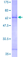 CTSZ / Cathepsin Z Protein - 12.5% SDS-PAGE of human CTSZ stained with Coomassie Blue