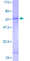 CTSZ / Cathepsin Z Protein - 12.5% SDS-PAGE of human CTSZ stained with Coomassie Blue