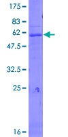 CTSZ / Cathepsin Z Protein - 12.5% SDS-PAGE of human CTSZ stained with Coomassie Blue