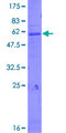 CTSZ / Cathepsin Z Protein - 12.5% SDS-PAGE of human CTSZ stained with Coomassie Blue