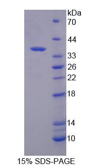 CTSZ / Cathepsin Z Protein - Recombinant  Cathepsin Z By SDS-PAGE