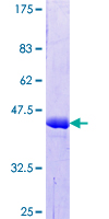CTTN / Cortactin Protein - 12.5% SDS-PAGE Stained with Coomassie Blue.