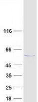 CTU2 Protein - Purified recombinant protein CTU2 was analyzed by SDS-PAGE gel and Coomassie Blue Staining