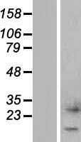 CTXN1 Protein - Western validation with an anti-DDK antibody * L: Control HEK293 lysate R: Over-expression lysate
