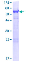 CUEDC1 Protein - 12.5% SDS-PAGE of human CUEDC1 stained with Coomassie Blue