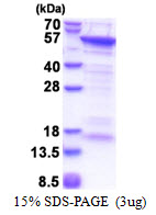 CUEDC1 Protein