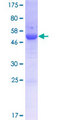 CUEDC2 Protein - 12.5% SDS-PAGE of human CUEDC2 stained with Coomassie Blue