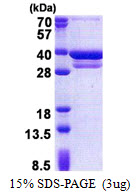 CUEDC2 Protein