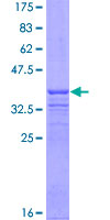 CUL3 / Cullin 3 Protein - 12.5% SDS-PAGE Stained with Coomassie Blue.