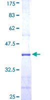 CUL5 / Cullin-5 Protein - 12.5% SDS-PAGE Stained with Coomassie Blue.