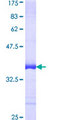 CUL7 Protein - 12.5% SDS-PAGE Stained with Coomassie Blue.