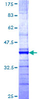 CUL9 / Cullin 9 Protein - 12.5% SDS-PAGE Stained with Coomassie Blue.
