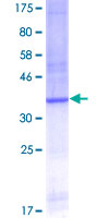 Cullin 4A / CUL4A Protein - 12.5% SDS-PAGE Stained with Coomassie Blue.