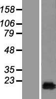 CUTA Protein - Western validation with an anti-DDK antibody * L: Control HEK293 lysate R: Over-expression lysate