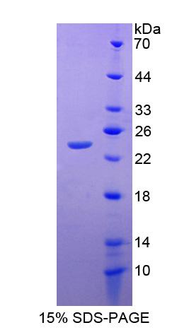 CUTA Protein - Recombinant Acetylcholinesterase Associated Protein By SDS-PAGE
