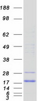 CUTA Protein - Purified recombinant protein CUTA was analyzed by SDS-PAGE gel and Coomassie Blue Staining