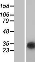 CUTC Protein - Western validation with an anti-DDK antibody * L: Control HEK293 lysate R: Over-expression lysate