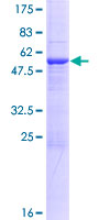 CUTC Protein - 12.5% SDS-PAGE of human CUTC stained with Coomassie Blue