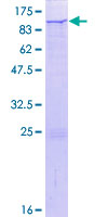 CUX1 / CASP Protein - 12.5% SDS-PAGE of human CUX1 stained with Coomassie Blue
