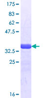 CUX2 Protein - 12.5% SDS-PAGE Stained with Coomassie Blue.