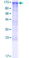 CWC22 Protein - 12.5% SDS-PAGE of human KIAA1604 stained with Coomassie Blue
