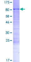 CWC25 Protein - 12.5% SDS-PAGE of human CCDC49 stained with Coomassie Blue