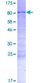 CWC25 Protein - 12.5% SDS-PAGE of human CCDC49 stained with Coomassie Blue