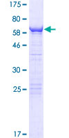 CWC27 Protein - 12.5% SDS-PAGE of human SDCCAG10 stained with Coomassie Blue