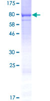 CWF19L1 Protein - 12.5% SDS-PAGE of human CWF19L1 stained with Coomassie Blue
