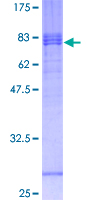 CX3CL1 / Fractalkine Protein - 12.5% SDS-PAGE of human CX3CL1 stained with Coomassie Blue