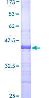 CX3CL1 / Fractalkine Protein - 12.5% SDS-PAGE Stained with Coomassie Blue.