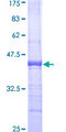 CX3CL1 / Fractalkine Protein - 12.5% SDS-PAGE Stained with Coomassie Blue.