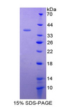 CX3CL1 / Fractalkine Protein - Recombinant Chemokine C-X3-C-Motif Ligand 1 By SDS-PAGE