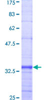 CX3CR1 Protein - 12.5% SDS-PAGE Stained with Coomassie Blue.