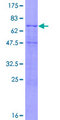 CXADR Protein - 12.5% SDS-PAGE of human CXADR stained with Coomassie Blue