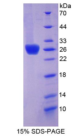 CXADR Protein - Recombinant Coxsackie Virus And Adenovirus Receptor By SDS-PAGE