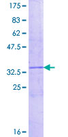 CXCL1 / GRO Alpha Protein - 12.5% SDS-PAGE of human CXCL1 stained with Coomassie Blue