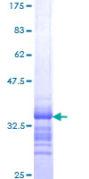 CXCL1 / GRO Alpha Protein - 12.5% SDS-PAGE Stained with Coomassie Blue.