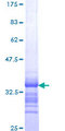 CXCL1 / GRO Alpha Protein - 12.5% SDS-PAGE Stained with Coomassie Blue.