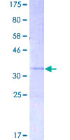 CXCL10 / IP-10 Protein - 12.5% SDS-PAGE of human CXCL10 stained with Coomassie Blue